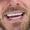 Hollywood Smile in VIP Clinic