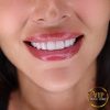 Hollywood Smile in VIP Clinic